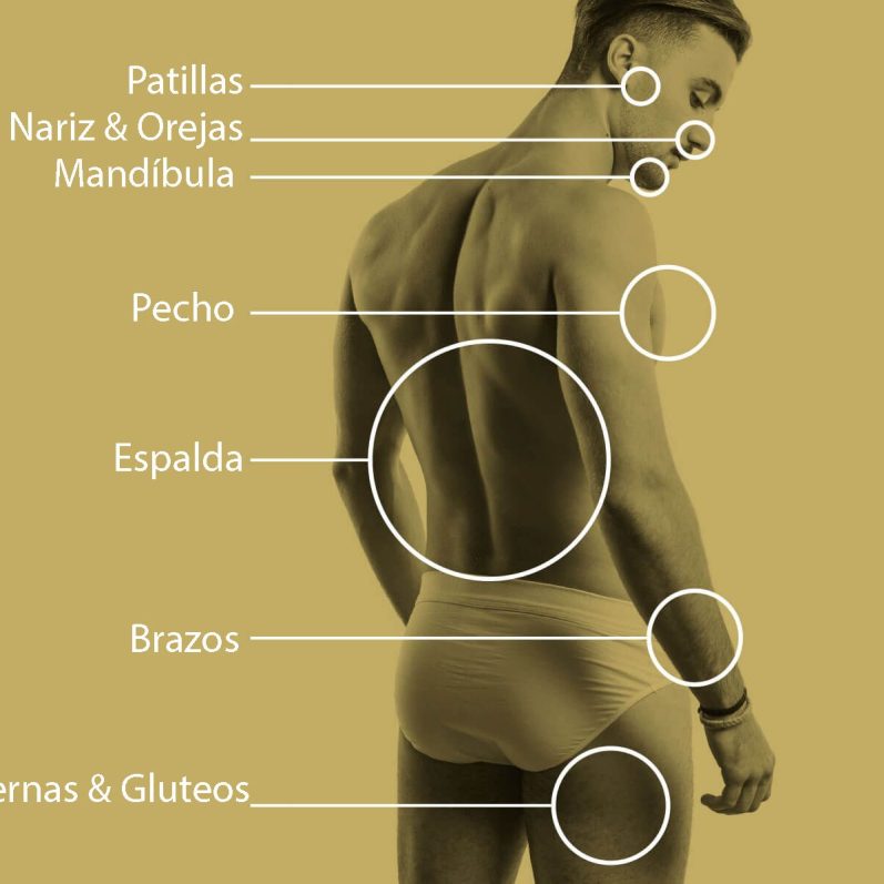 Se marcan las zonas mas populares que se piden para hacerse la depilación láser definitiva.